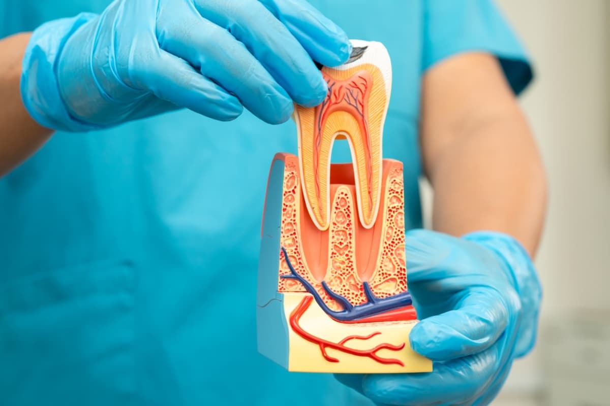 Root canal Treatment Escondido