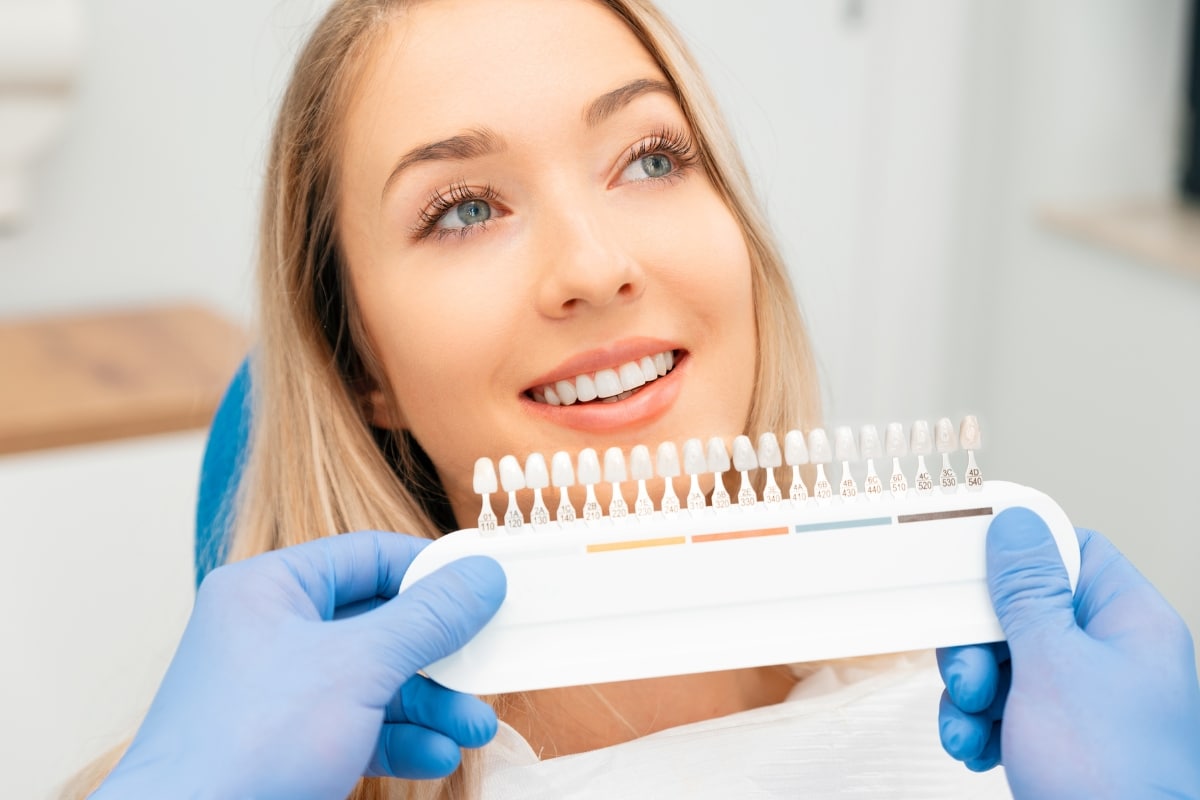 veneers in Escondido
