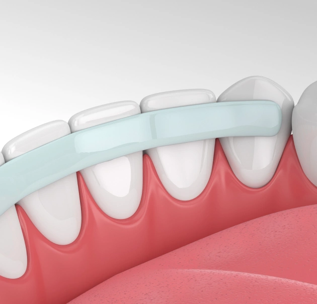 Dental illustration showing toothbrush cleaning teeth and gums in cross-section view.