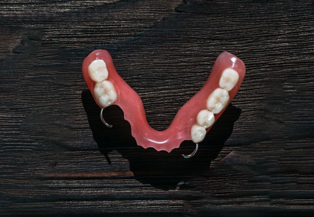 Dental prosthetic model showing upper teeth arrangement on dark wooden surface.