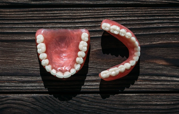 Dental models showing upper and lower teeth arrangements on dark wooden surface.