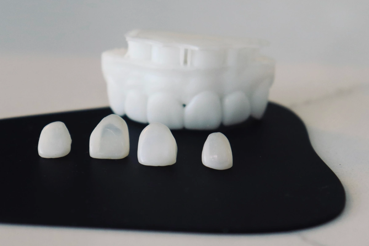 Dental crowns and tooth model displayed on black cloth for dental care demonstration.