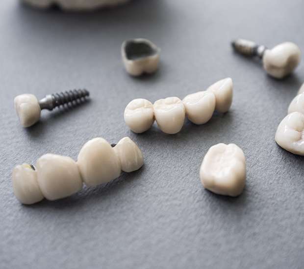 Escondido The Difference Between Dental Implants and Mini Dental Implants